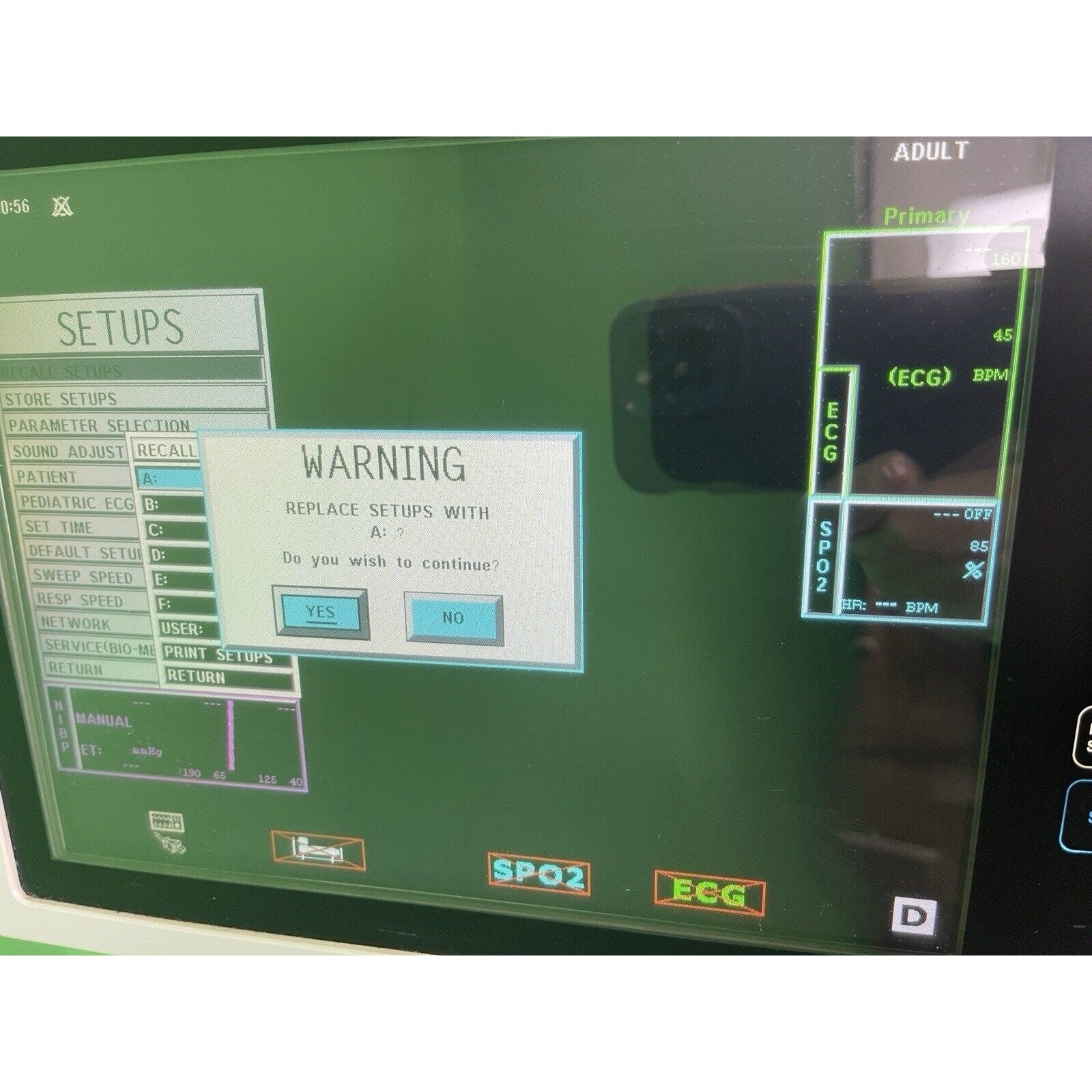 Philips Invivo Expression MRI Model 865214 Monitor W/ Cart