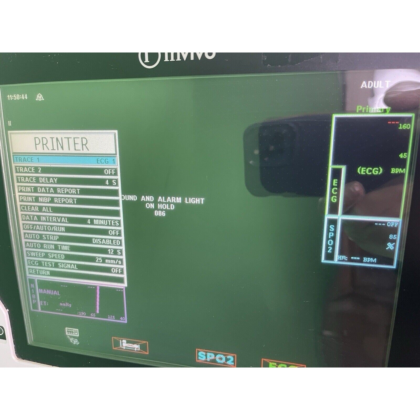 Philips Invivo Expression MRI Model 865214 Monitor W/ Cart