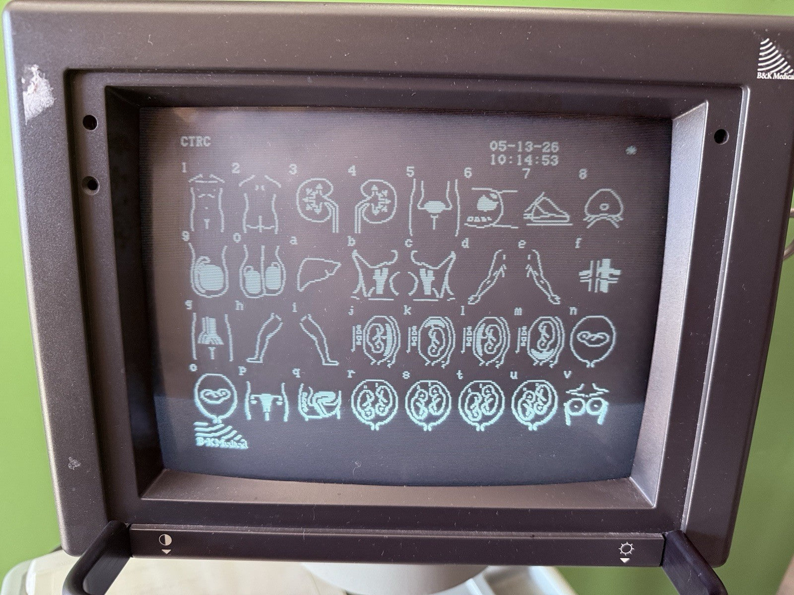 B&K Medical Leopard Ultrasound type 2001
