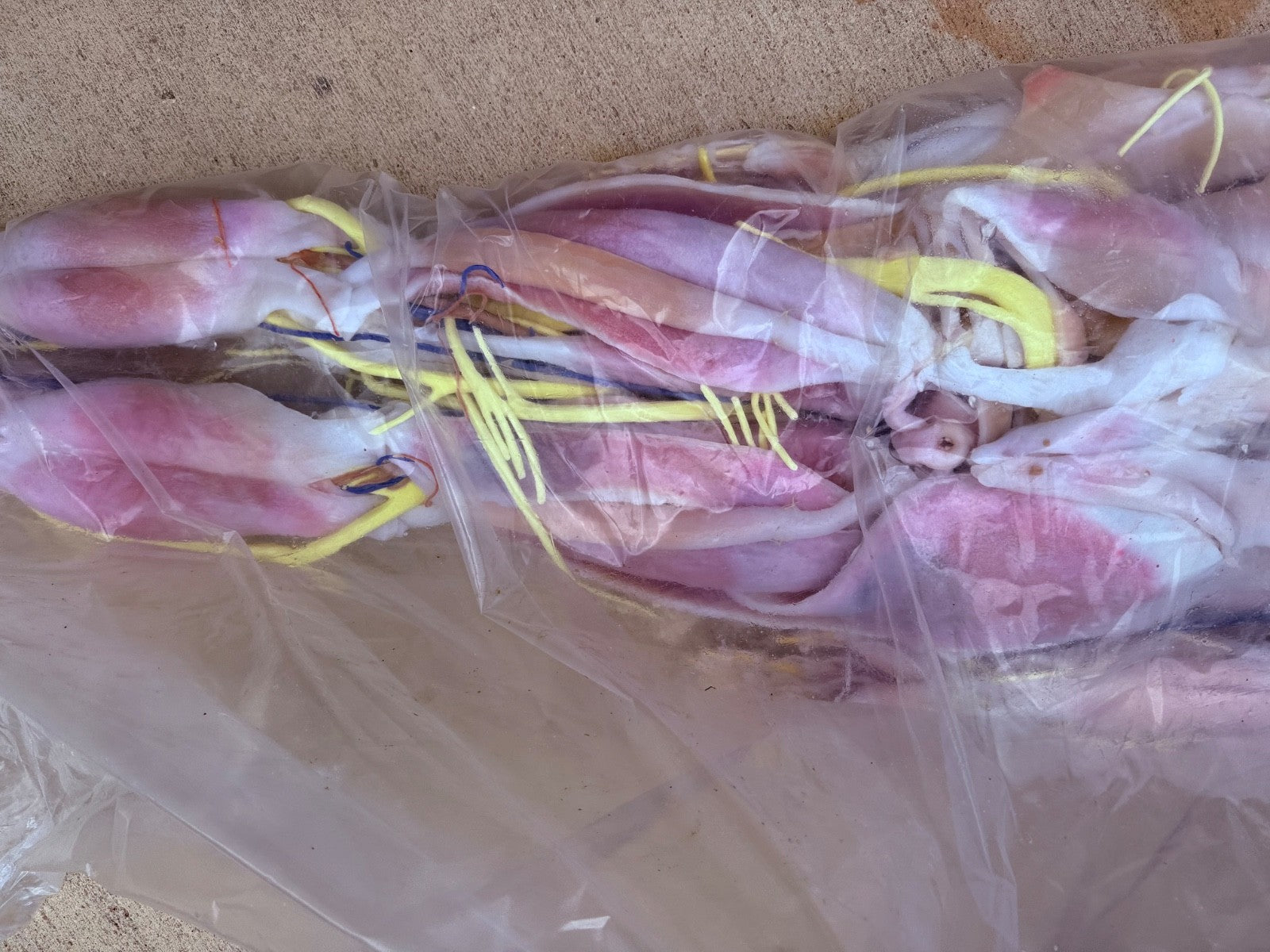 SynDaver Human Anatomy Model Realistic Medical Trainer Full Size $81k